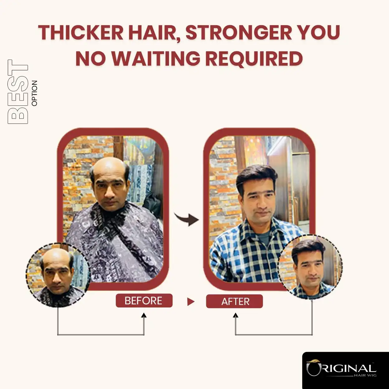 MONO 5.1 Men’s Hair Patch – 100% Human Hair Natural Appearance